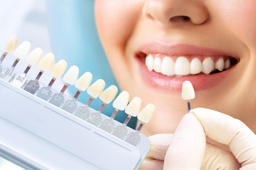 A closeup of a woman’s smile
